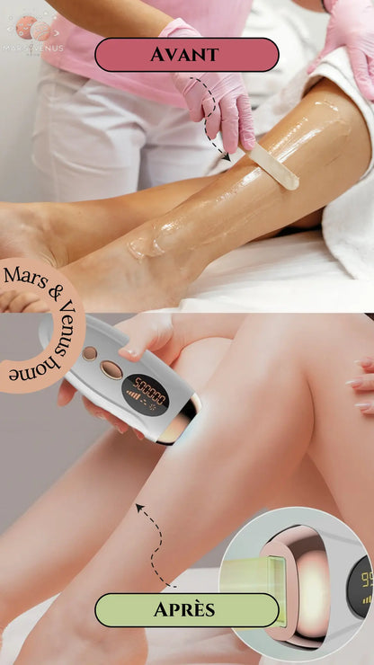 Épilateur Laser IPL rose : corps, bikini et visage Mars & Venus Home