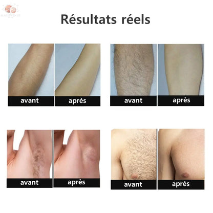 Épilateur Laser IPL rose : corps, bikini et visage Mars & Venus Home